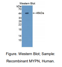 人肌钯蛋白(MYPN)多克隆抗体
