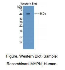 https://msimg.bioon.com/bionline/goods-no-pic.png