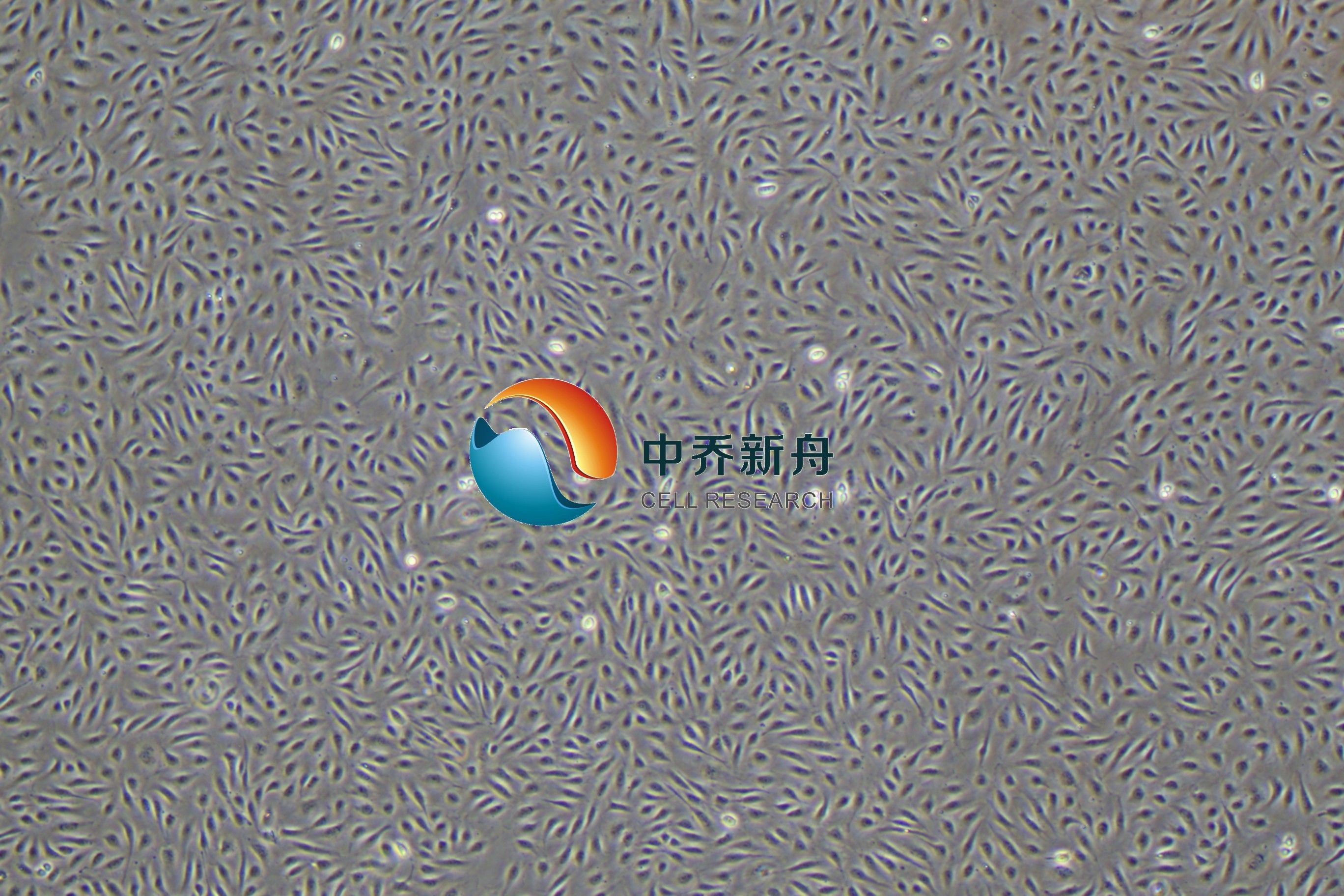 人脐带血来源内皮祖细胞