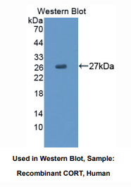 https://msimg.bioon.com/bionline/goods-no-pic.png