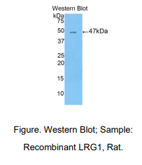 https://msimg.bioon.com/bionline/goods-no-pic.png