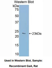 大鼠酸性葡糖苷酶α(GaA)多克隆抗体