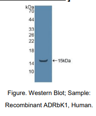 https://msimg.bioon.com/bionline/goods-no-pic.png