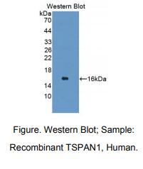 https://msimg.bioon.com/bionline/goods-no-pic.png