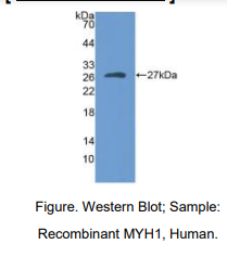 https://msimg.bioon.com/bionline/goods-no-pic.png