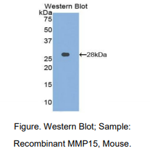 https://msimg.bioon.com/bionline/goods-no-pic.png