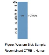 人糜蛋白酶原B1(CTRB1)多克隆抗体