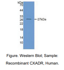 人柯萨奇病毒腺病毒受体(CXADR)多克隆抗体