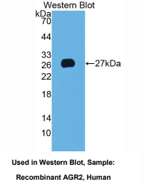 人前梯度蛋白2(AGR2)多克隆抗体