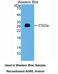 https://msimg.bioon.com/bionline/goods-no-pic.png