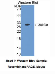 https://msimg.bioon.com/bionline/goods-no-pic.png