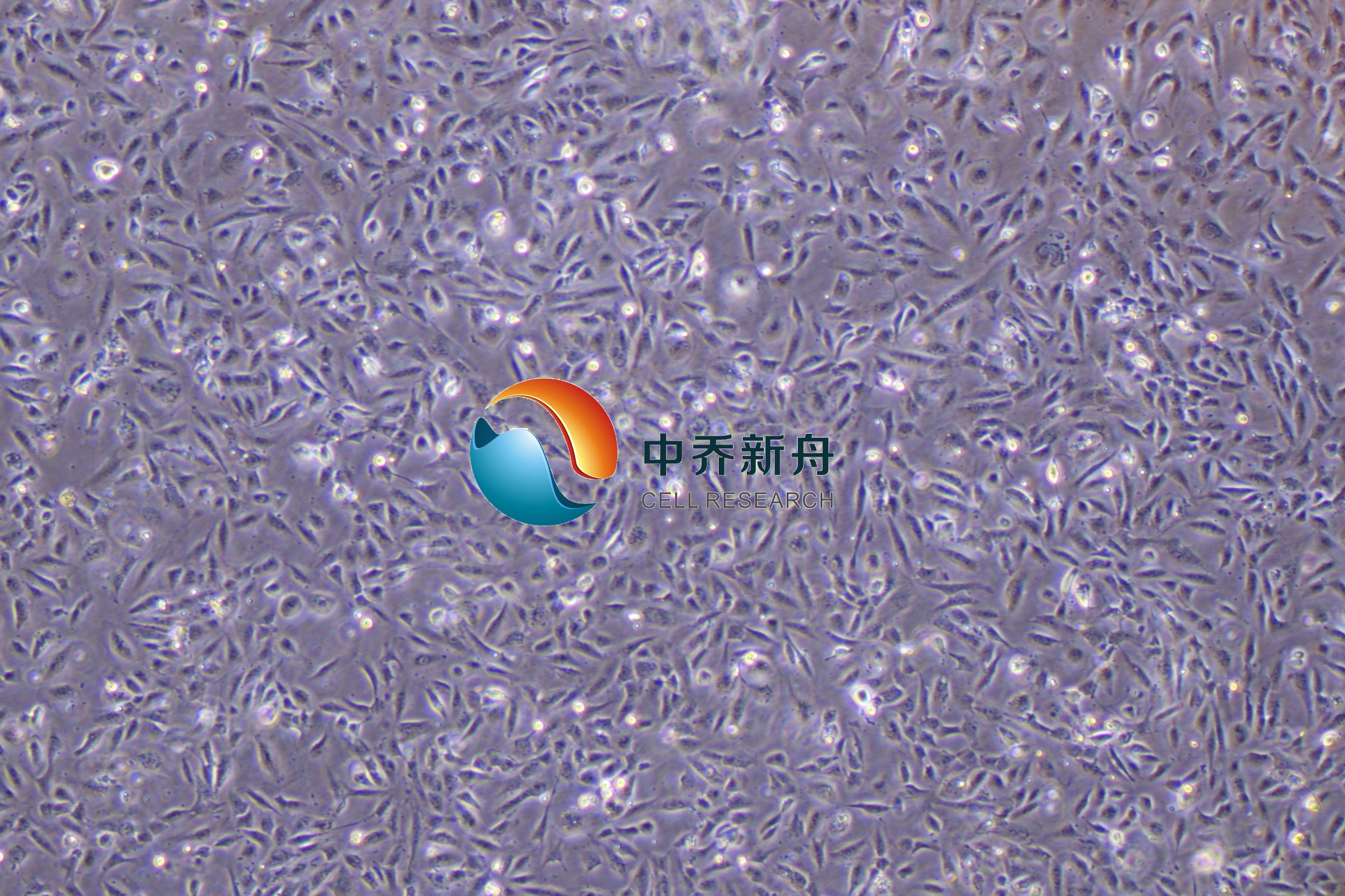 人视网膜微血管内皮细胞-永生化