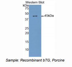 https://msimg.bioon.com/bionline/goods-no-pic.png