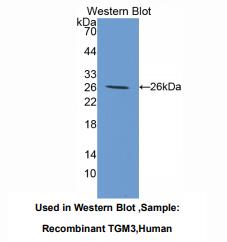 https://msimg.bioon.com/bionline/goods-no-pic.png