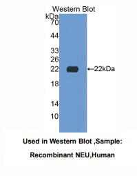 https://msimg.bioon.com/bionline/goods-no-pic.png