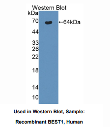 https://msimg.bioon.com/bionline/goods-no-pic.png