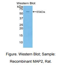大鼠微管关联蛋白2(MAP2)多克隆抗体