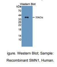 人运动神经元生存蛋白1(SMN)多克隆抗体