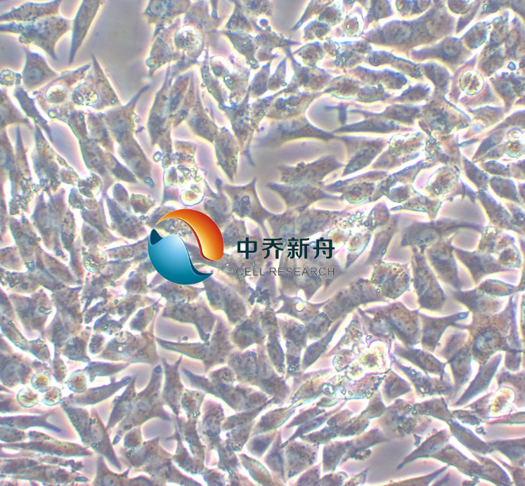 人甲状腺导管癌细胞