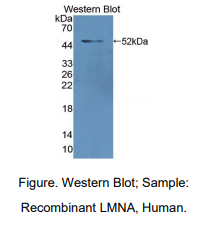 人核纤层蛋白A/C(LMNA)多克隆抗体