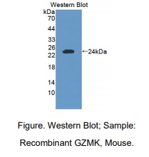 https://msimg.bioon.com/bionline/goods-no-pic.png