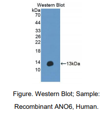 https://msimg.bioon.com/bionline/goods-no-pic.png