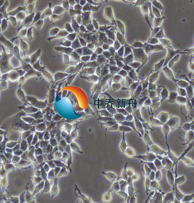 https://img.medsci.cn/8eee53bbc4cb7a98de615e72115896bc4e27fda5cbb764dbd67d9d641c2bb46a.png