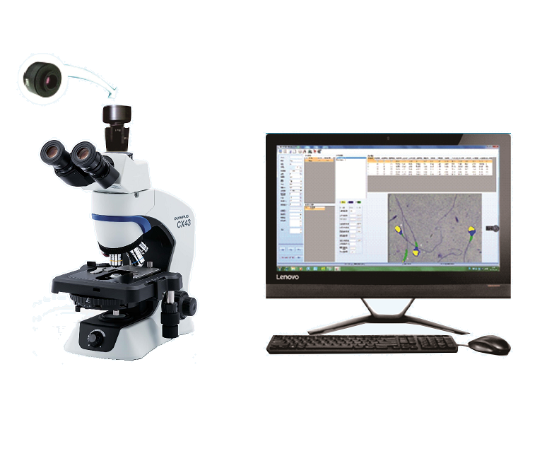全自动精子分析仪
