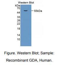 人鸟嘌呤脱氨酶(GDA)多克隆抗体