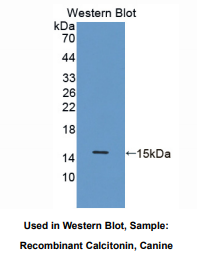 https://msimg.bioon.com/bionline/goods-no-pic.png