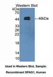 人精子关联抗原1(SPAG1)多克隆抗体