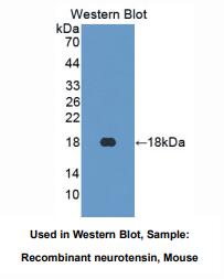 https://msimg.bioon.com/bionline/goods-no-pic.png