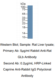 https://msimg.bioon.com/bionline/goods-no-pic.png