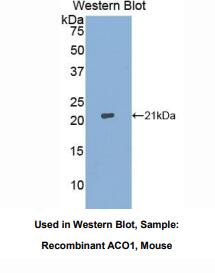 https://msimg.bioon.com/bionline/goods-no-pic.png