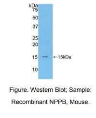 小鼠钠尿肽前体B(NPPB)多克隆抗体