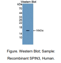 https://msimg.bioon.com/bionline/goods-no-pic.png