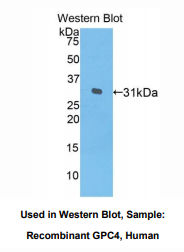 https://msimg.bioon.com/bionline/goods-no-pic.png