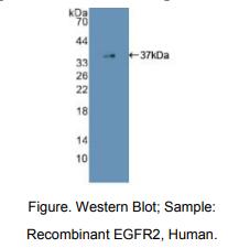人表皮生长因子受体(EGFR)多克隆抗体