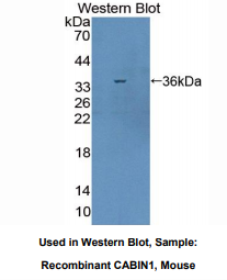 https://msimg.bioon.com/bionline/goods-no-pic.png