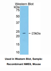 https://msimg.bioon.com/bionline/goods-no-pic.png