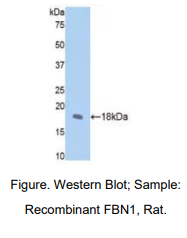 https://msimg.bioon.com/bionline/goods-no-pic.png