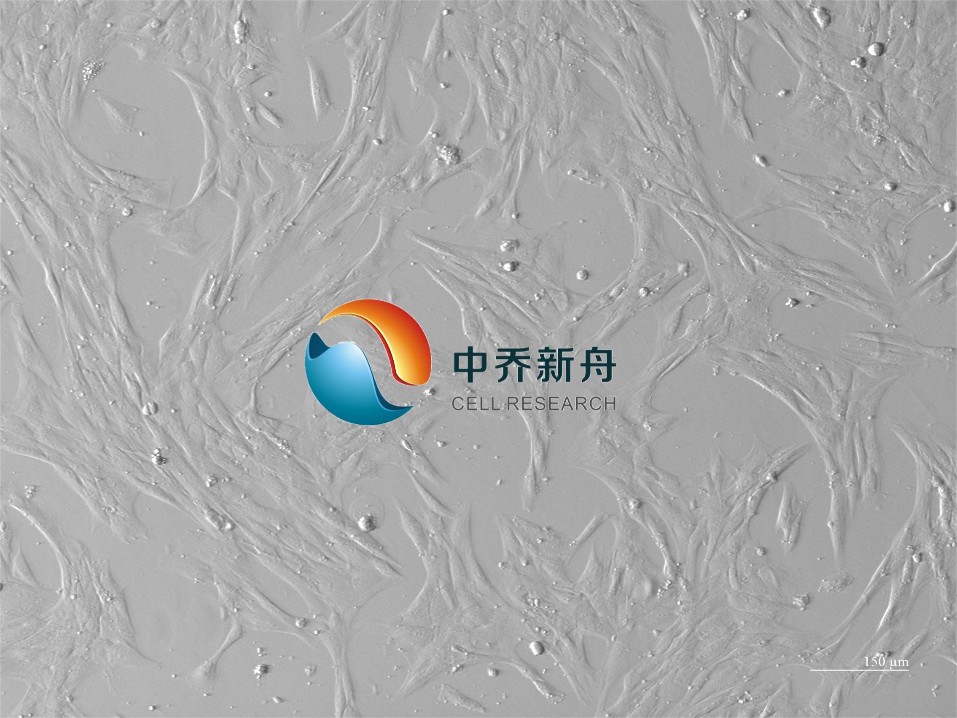 人乳腺癌成纤维细胞永生化