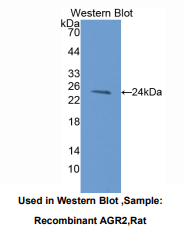 https://msimg.bioon.com/bionline/goods-no-pic.png