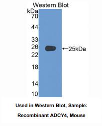 https://msimg.bioon.com/bionline/goods-no-pic.png