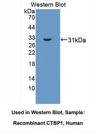 https://msimg.bioon.com/bionline/goods-no-pic.png