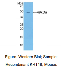 小鼠角蛋白18(CK18)多克隆抗体