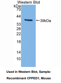 https://msimg.bioon.com/bionline/goods-no-pic.png