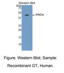 https://msimg.bioon.com/bionline/goods-no-pic.png