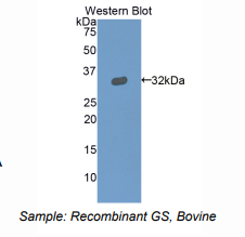 牛凝溶胶蛋白(GSN)多克隆抗体