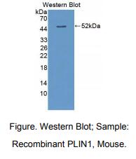 https://msimg.bioon.com/bionline/goods-no-pic.png